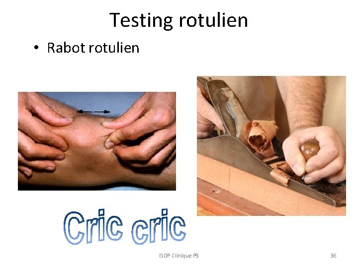 Testing rotulien • Rabot rotulien ISOP Clinique P 5 36 