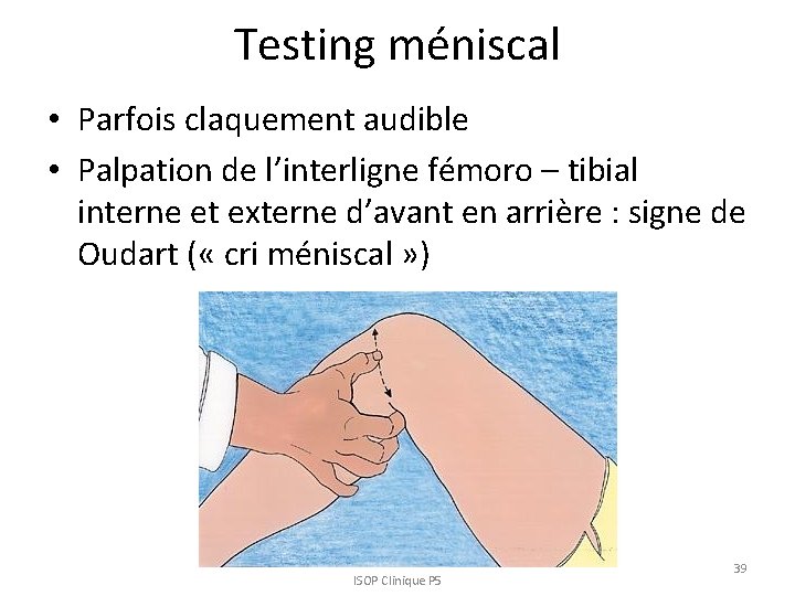 Testing méniscal • Parfois claquement audible • Palpation de l’interligne fémoro – tibial interne