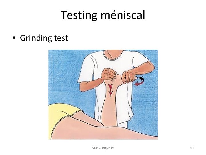 Testing méniscal • Grinding test ISOP Clinique P 5 40 