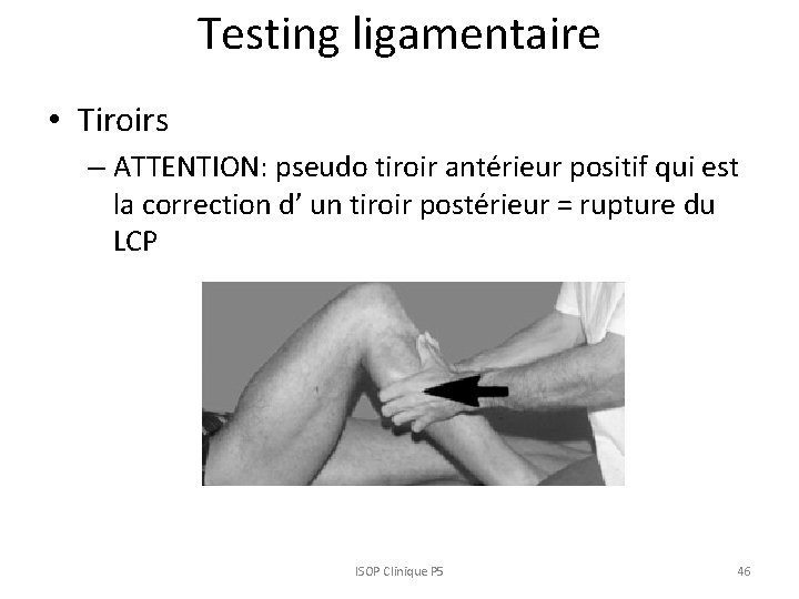 Testing ligamentaire • Tiroirs – ATTENTION: pseudo tiroir antérieur positif qui est la correction