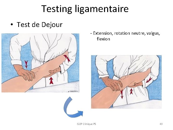 Testing ligamentaire • Test de Dejour - Extension, rotation neutre, valgus, flexion ISOP Clinique