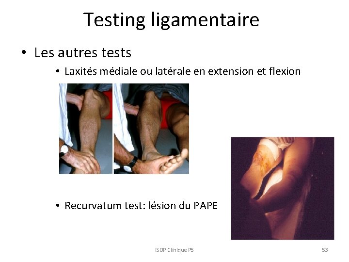 Testing ligamentaire • Les autres tests • Laxités médiale ou latérale en extension et