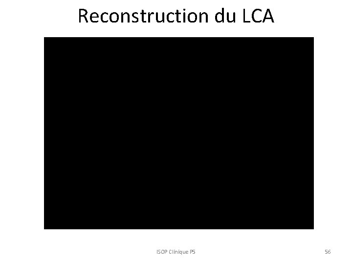 Reconstruction du LCA ISOP Clinique P 5 56 