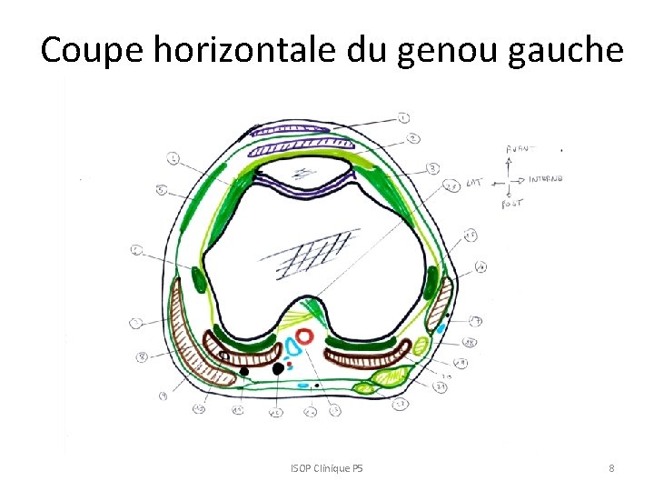 Coupe horizontale du genou gauche ISOP Clinique P 5 8 