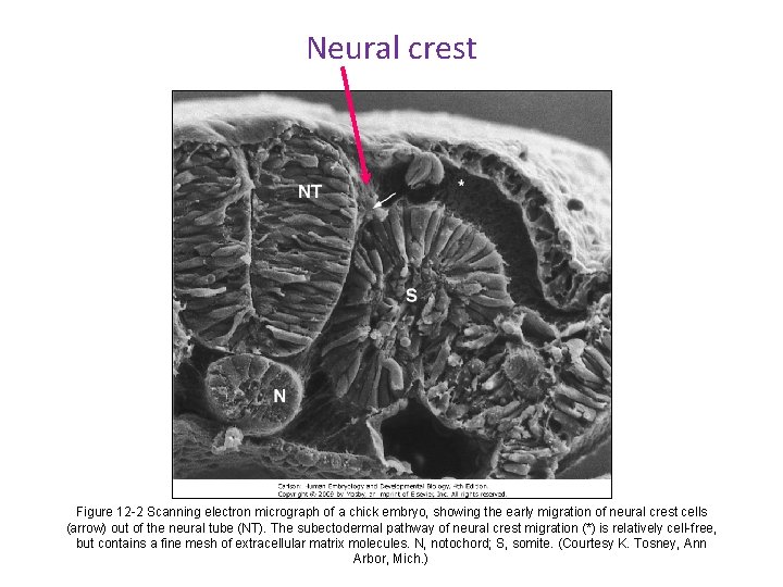 Neural crest Figure 12 -2 Scanning electron micrograph of a chick embryo, showing the