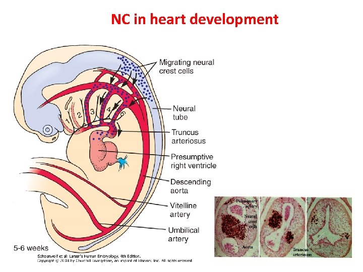 NC in heart development 