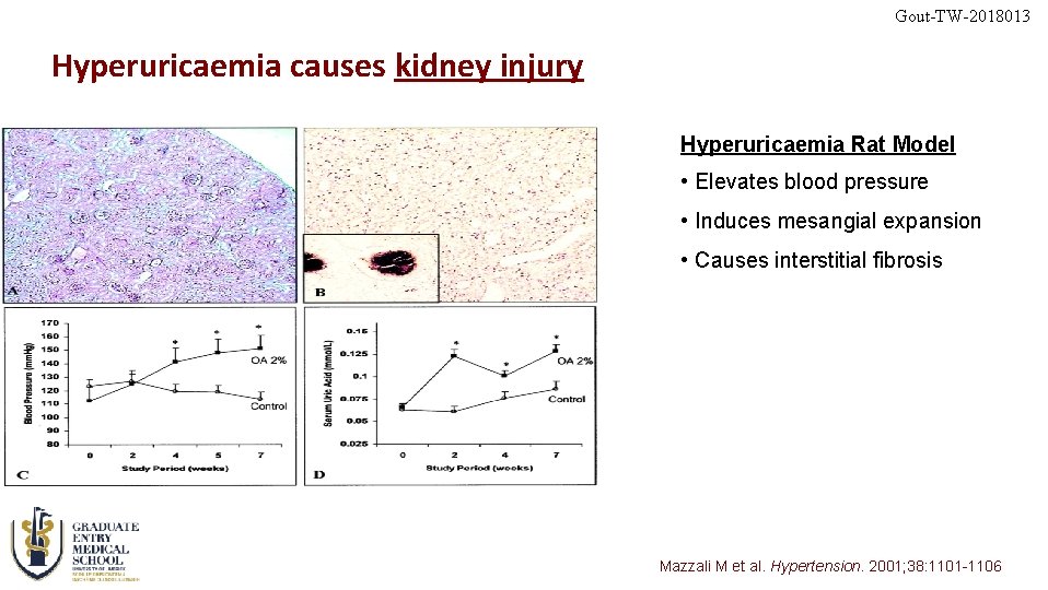 Gout-TW-2018013 Hyperuricaemia causes kidney injury Hyperuricaemia Rat Model • Elevates blood pressure • Induces