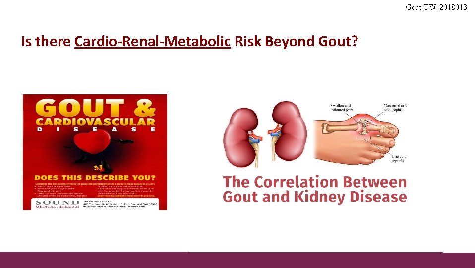 Gout-TW-2018013 Is there Cardio-Renal-Metabolic Risk Beyond Gout? 