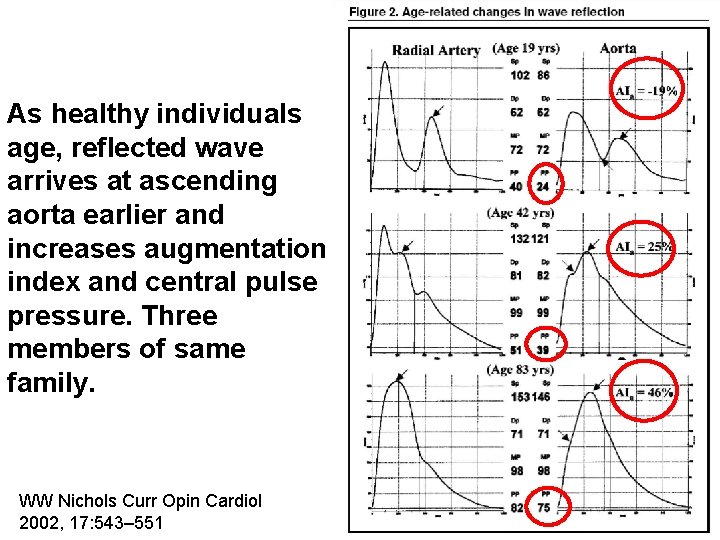 As healthy individuals age, reflected wave arrives at ascending aorta earlier and increases augmentation As healthy individuals age, reflected wave arrives at ascending aorta earlier and increases augmentation
