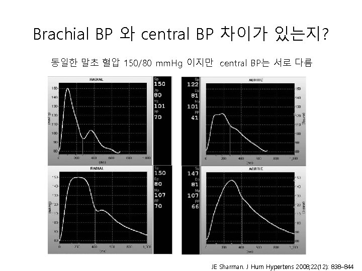 Brachial BP 와 central BP 차이가 있는지? 동일한 말초 혈압 150/80 mm. Hg 이지만 Brachial BP 와 central BP 차이가 있는지? 동일한 말초 혈압 150/80 mm. Hg 이지만