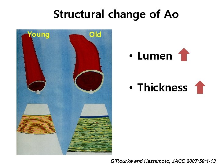 Structural change of Ao Young Old • Lumen • Thickness O’Rourke and Hashimoto, JACC Structural change of Ao Young Old • Lumen • Thickness O’Rourke and Hashimoto, JACC