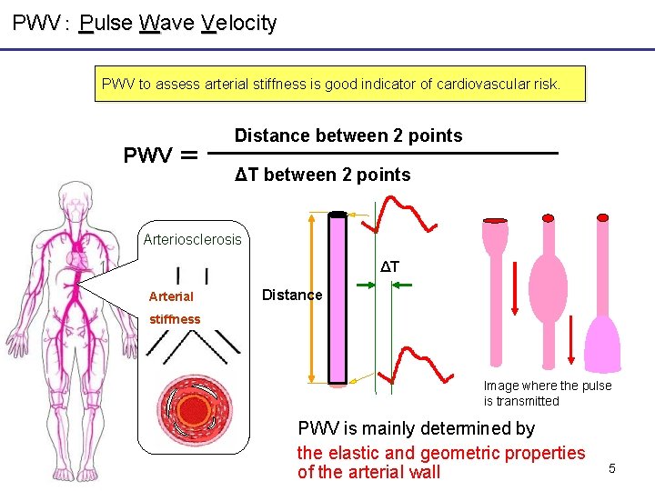 PWV: Pulse Wave Velocity PWV to assess arterial stiffness is good indicator of cardiovascular PWV: Pulse Wave Velocity PWV to assess arterial stiffness is good indicator of cardiovascular