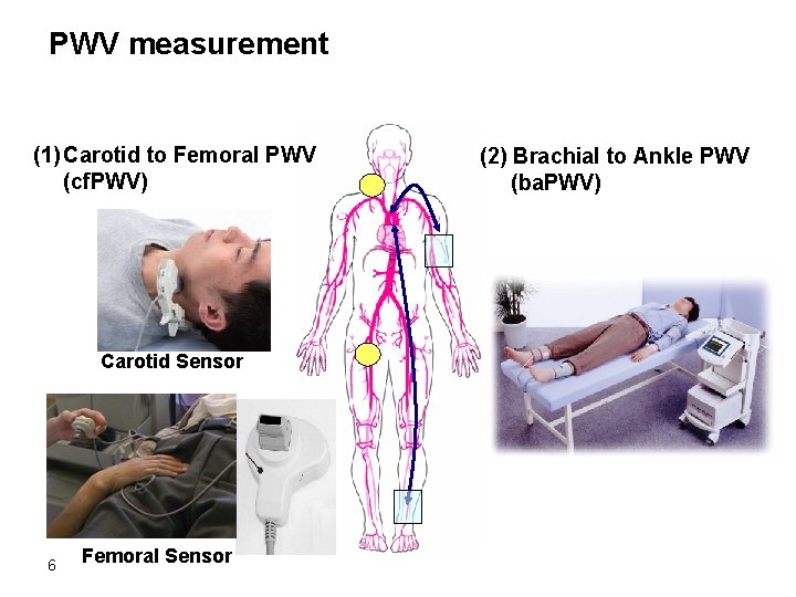 PWV measurement (1) Carotid to Femoral PWV (cf. PWV) Carotid Sensor 6 Femoral Sensor PWV measurement (1) Carotid to Femoral PWV (cf. PWV) Carotid Sensor 6 Femoral Sensor