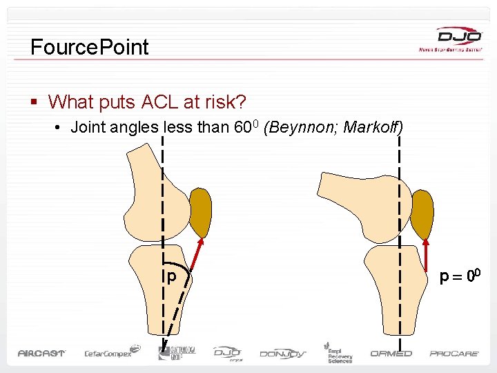 Fource. Point § What puts ACL at risk? • Joint angles less than 600
