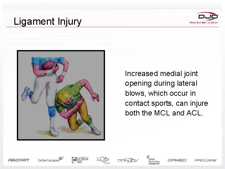 Ligament Injury Increased medial joint opening during lateral blows, which occur in contact sports,