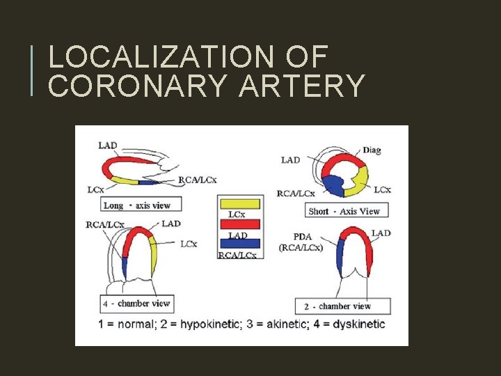 LOCALIZATION OF CORONARY ARTERY 