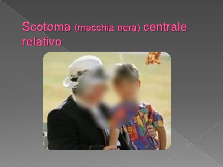 Scotoma (macchia nera) centrale relativo 