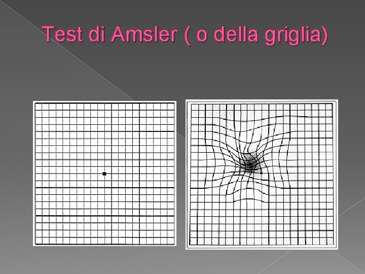 Test di Amsler ( o della griglia) 