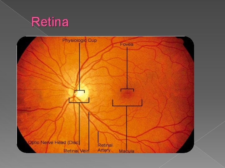 Retina 