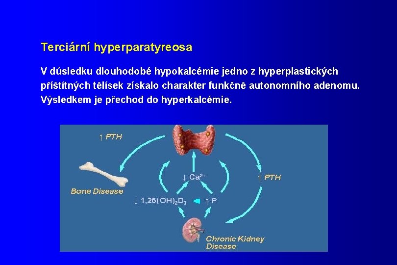 Terciární hyperparatyreosa V důsledku dlouhodobé hypokalcémie jedno z hyperplastických příštítných tělísek získalo charakter funkčně