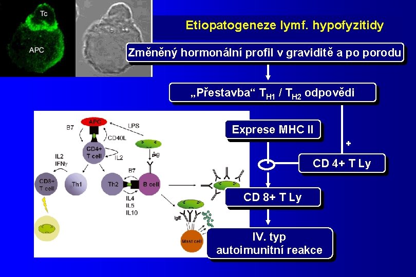 Etiopatogeneze lymf. hypofyzitidy Změněný hormonální profil v graviditě a po porodu „Přestavba“ TH 1