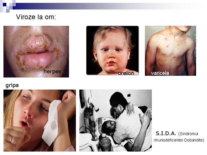 Viroze la om: herpes oreion varicela gripa S. I. D. A. (Sindromul Imunodeficientei Dobandite)