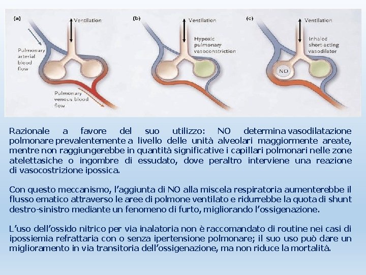 Razionale a favore del suo utilizzo: NO determina vasodilatazione polmonare prevalentemente a livello delle