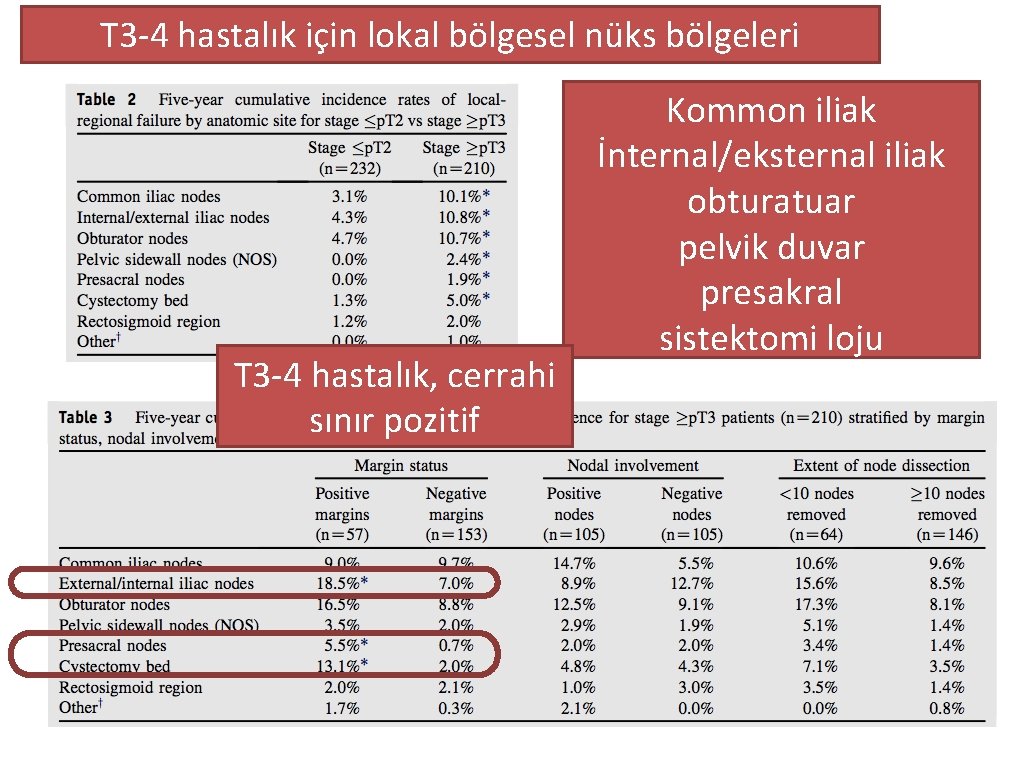 T 3 -4 hastalık için lokal bölgesel nüks bölgeleri T 3 -4 hastalık, cerrahi