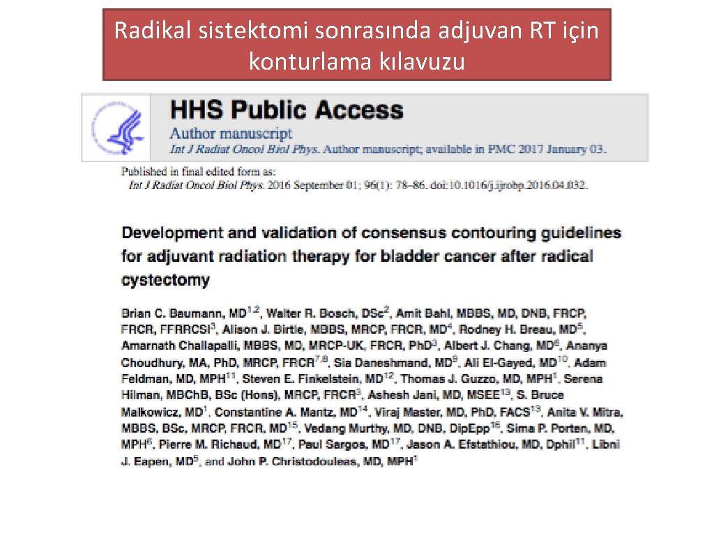 Radikal sistektomi sonrasında adjuvan RT için konturlama kılavuzu 