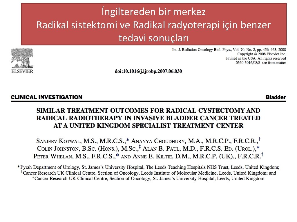 İngiltereden bir merkez Radikal sistektomi ve Radikal radyoterapi için benzer tedavi sonuçları 