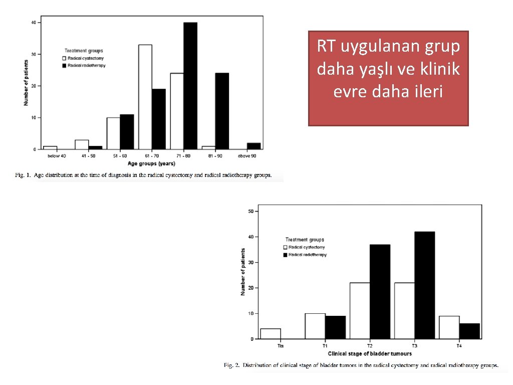 RT uygulanan grup daha yaşlı ve klinik evre daha ileri 