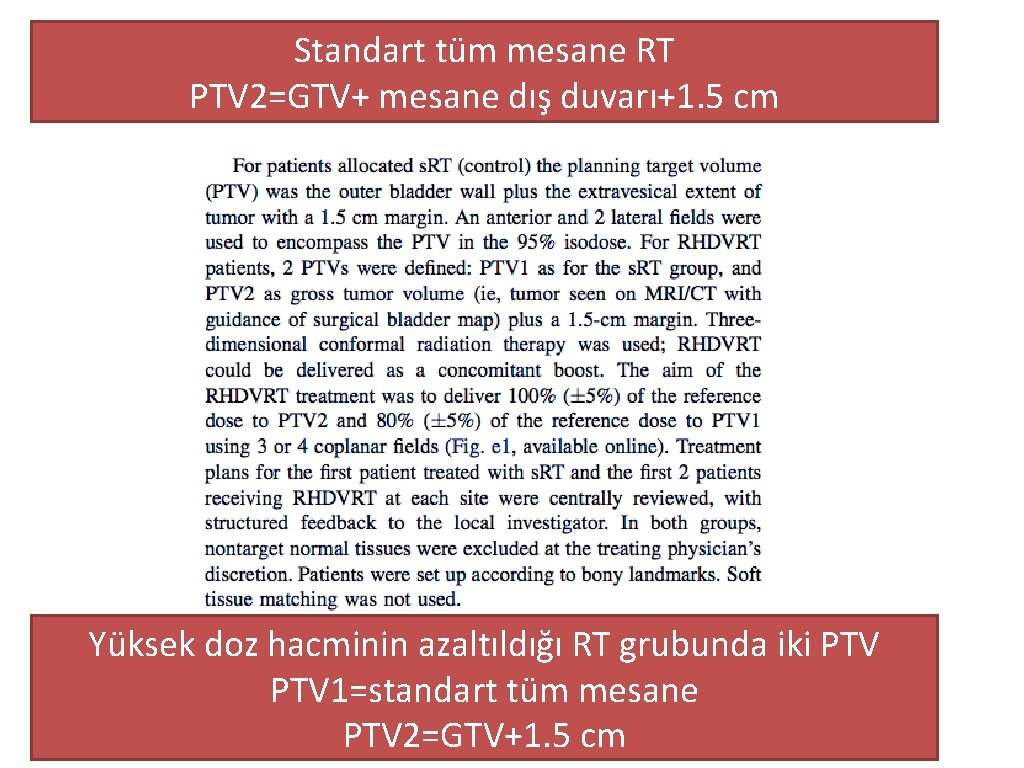 Standart tüm mesane RT PTV 2=GTV+ mesane dış duvarı+1. 5 cm Yüksek doz hacminin