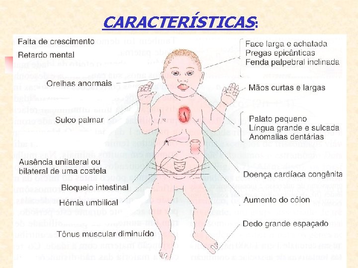 CARACTERÍSTICAS: 