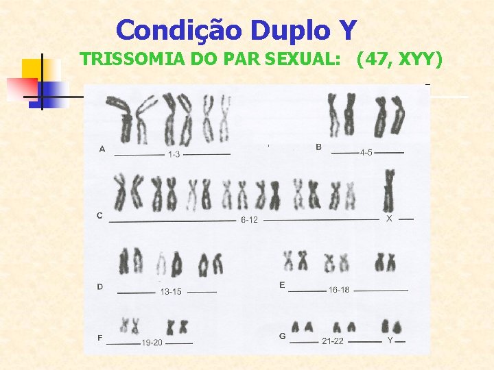 Condição Duplo Y TRISSOMIA DO PAR SEXUAL: (47, XYY) 