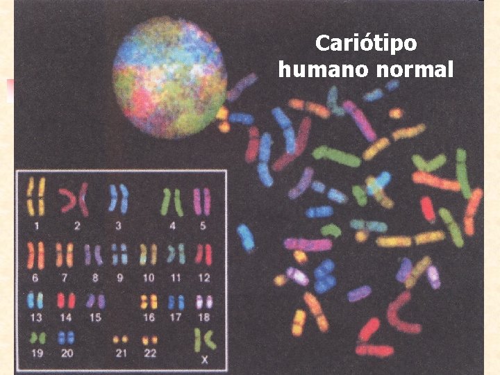 Cariótipo humano normal 