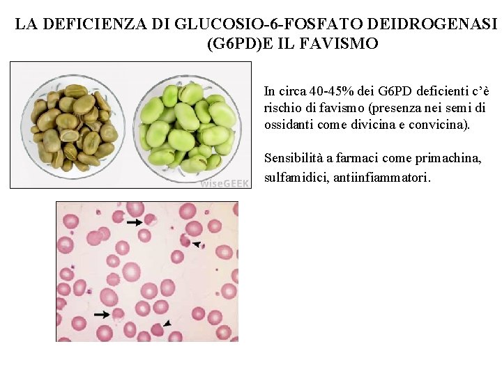 LA DEFICIENZA DI GLUCOSIO-6 -FOSFATO DEIDROGENASI (G 6 PD)E IL FAVISMO In circa 40 LA DEFICIENZA DI GLUCOSIO-6 -FOSFATO DEIDROGENASI (G 6 PD)E IL FAVISMO In circa 40