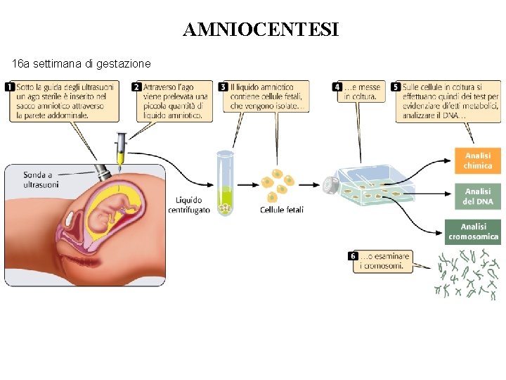 AMNIOCENTESI 16 a settimana di gestazione AMNIOCENTESI 16 a settimana di gestazione