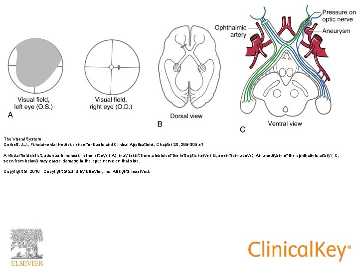 The Visual System Corbett, J. J. , Fundamental Neuroscience for Basic and Clinical Applications,