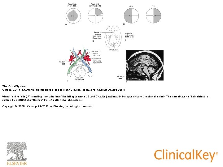 The Visual System Corbett, J. J. , Fundamental Neuroscience for Basic and Clinical Applications, The Visual System Corbett, J. J. , Fundamental Neuroscience for Basic and Clinical Applications,