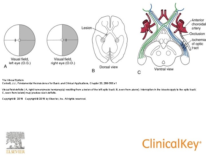 The Visual System Corbett, J. J. , Fundamental Neuroscience for Basic and Clinical Applications,