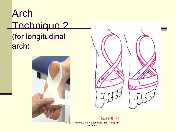 Arch Technique 2 (for longitudinal arch) Figure 8 -21 © 2011 Mc. Graw-Hill Higher