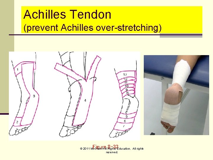 Achilles Tendon (prevent Achilles over-stretching) Figure 8 -33 © 2011 Mc. Graw-Hill Higher Education.
