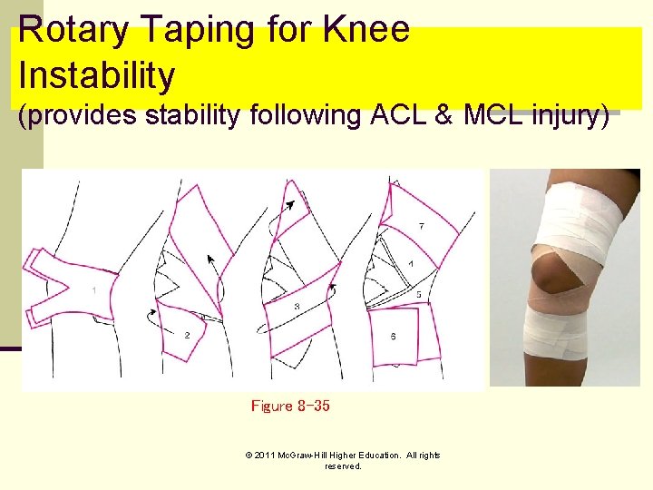 Rotary Taping for Knee Instability (provides stability following ACL & MCL injury) Figure 8