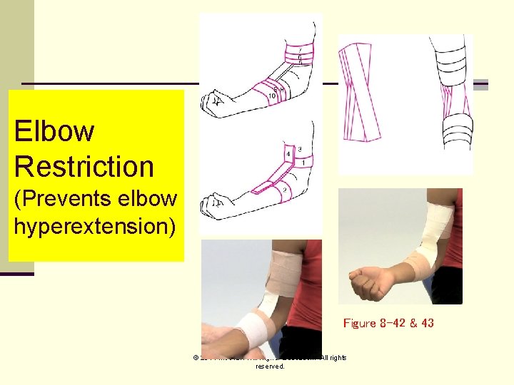 Elbow Restriction (Prevents elbow hyperextension) Figure 8 -42 & 43 © 2011 Mc. Graw-Hill