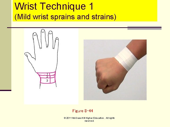 Wrist Technique 1 (Mild wrist sprains and strains) Figure 8 -44 © 2011 Mc.