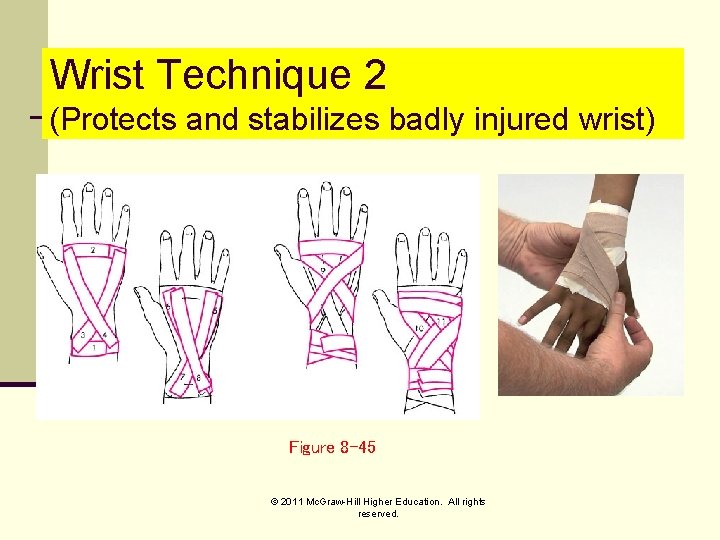 Wrist Technique 2 (Protects and stabilizes badly injured wrist) Figure 8 -45 © 2011