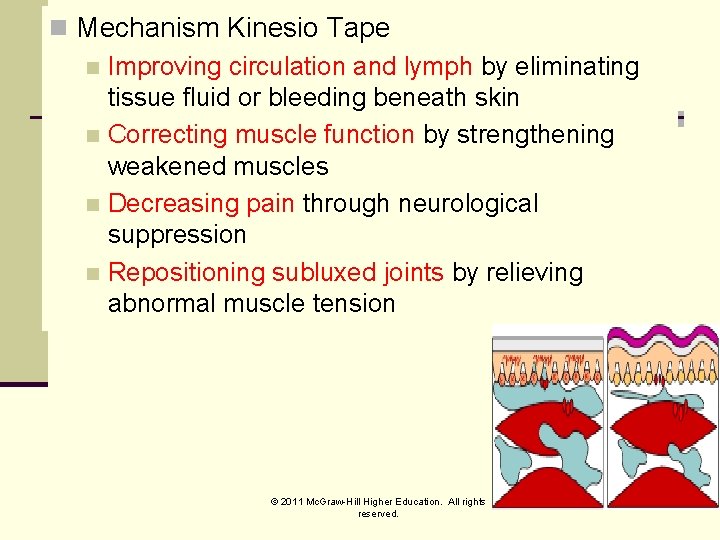 n Mechanism Kinesio Tape n Improving circulation and lymph by eliminating tissue fluid or