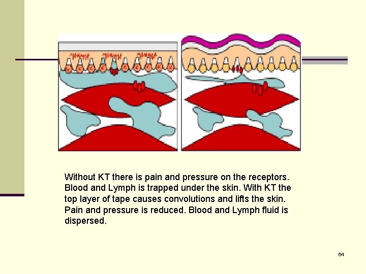 Without KT there is pain and pressure on the receptors. Blood and Lymph is