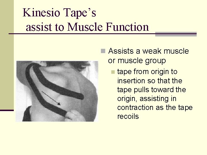 Kinesio Tape’s assist to Muscle Function n Assists a weak muscle or muscle group
