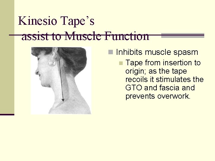Kinesio Tape’s assist to Muscle Function n Inhibits muscle spasm n Tape from insertion